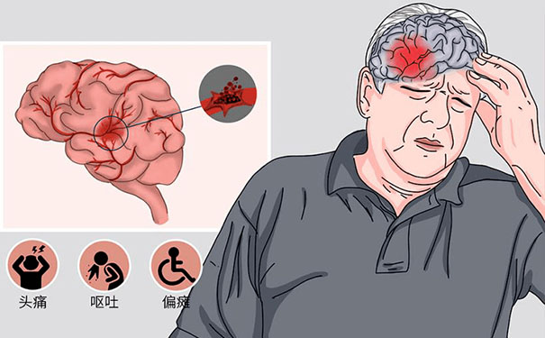 大眾康養(yǎng)網(wǎng)為腦梗病人通過快速篩選康復(fù)醫(yī)院服務(wù)，抓住腦梗康復(fù)黃金期
